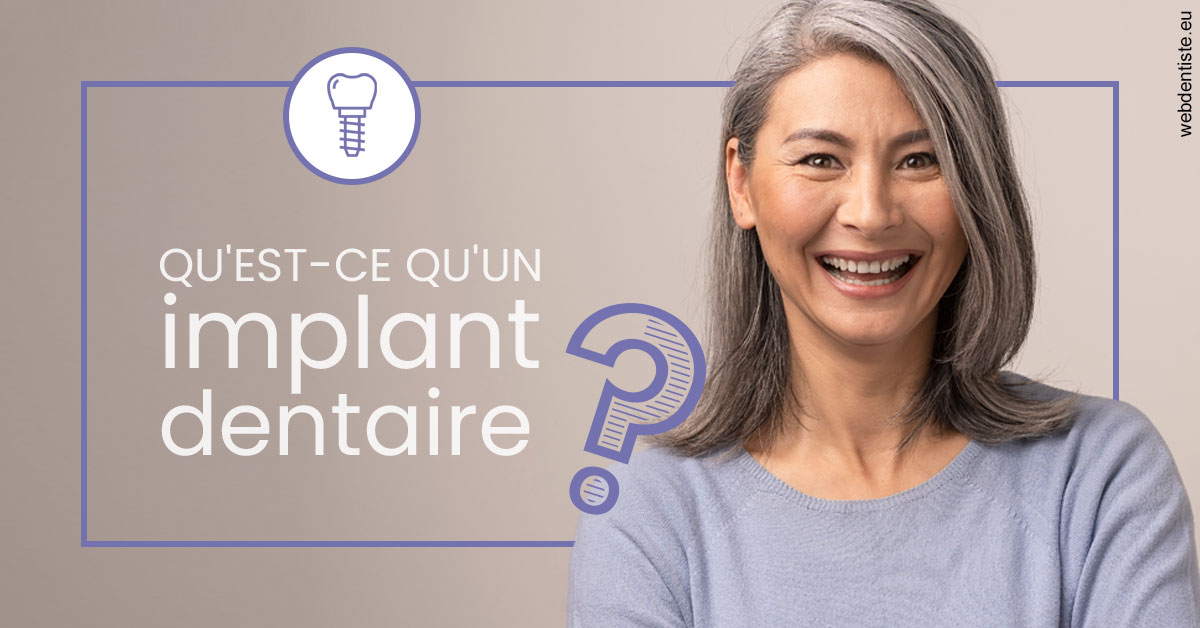 https://dr-abbou-michel.chirurgiens-dentistes.fr/Implant dentaire 1