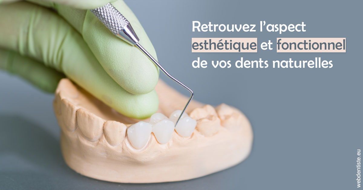 https://dr-abbou-michel.chirurgiens-dentistes.fr/Restaurations dentaires 1