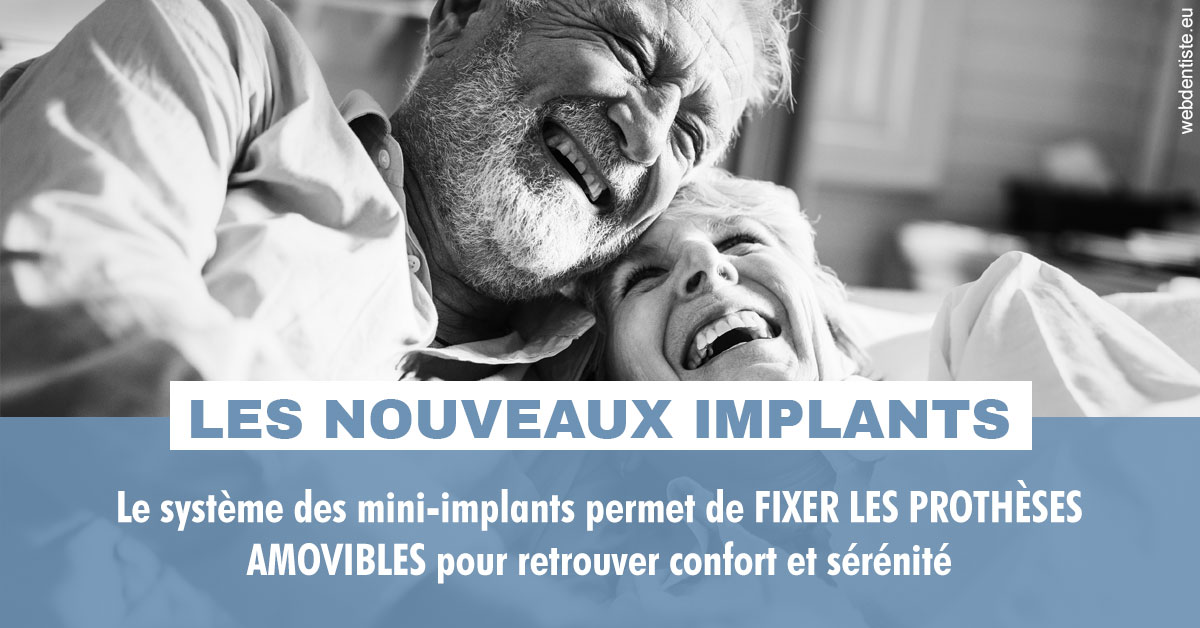 https://dr-abbou-michel.chirurgiens-dentistes.fr/Les nouveaux implants 2