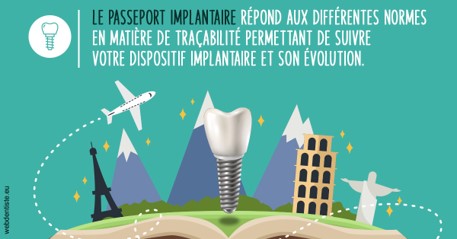 https://dr-abbou-michel.chirurgiens-dentistes.fr/Le passeport implantaire
