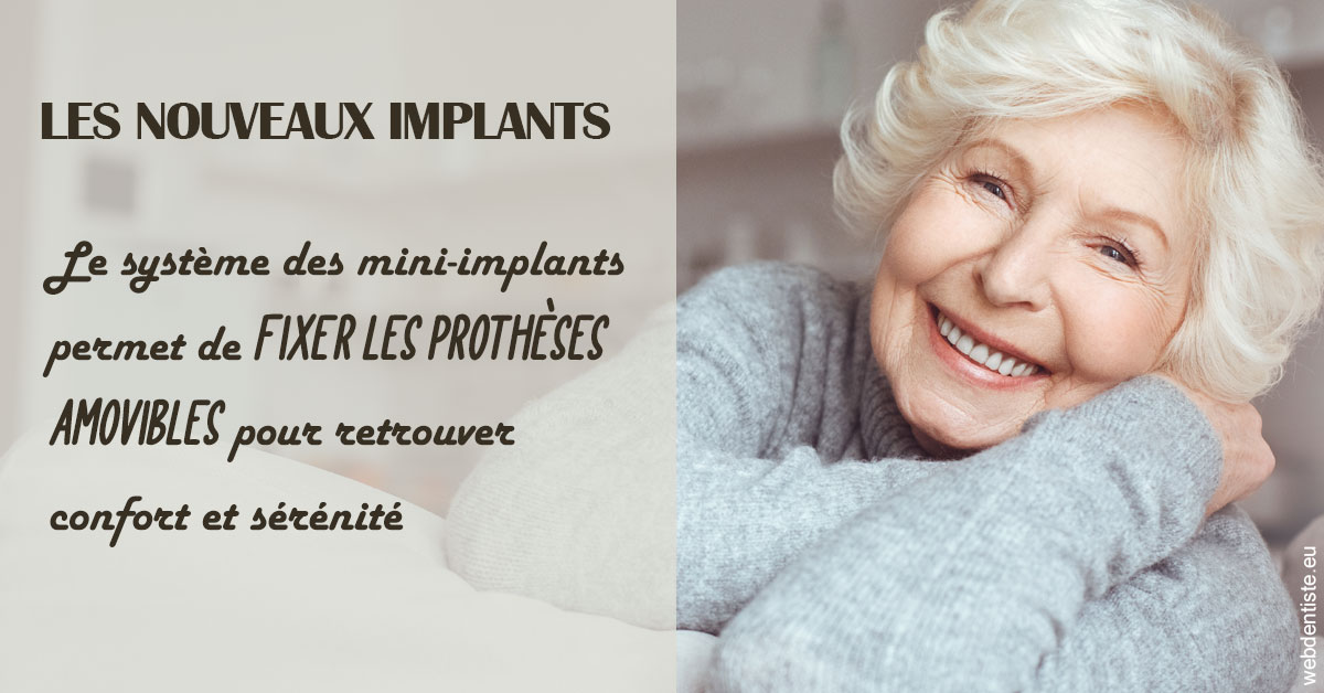 https://dr-abbou-michel.chirurgiens-dentistes.fr/Les nouveaux implants 1