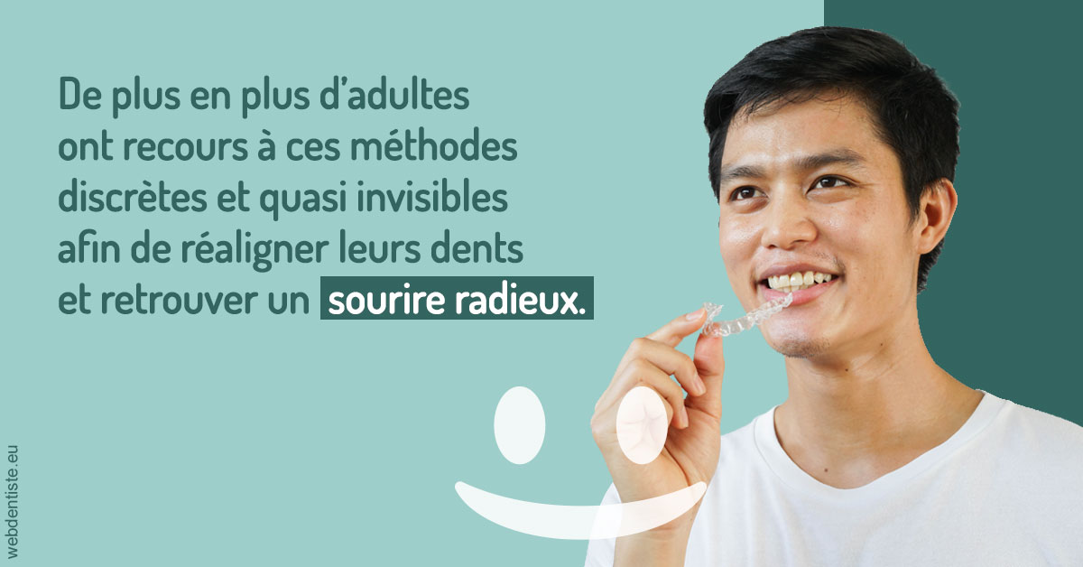 https://dr-abbou-michel.chirurgiens-dentistes.fr/Gouttières sourire radieux 2