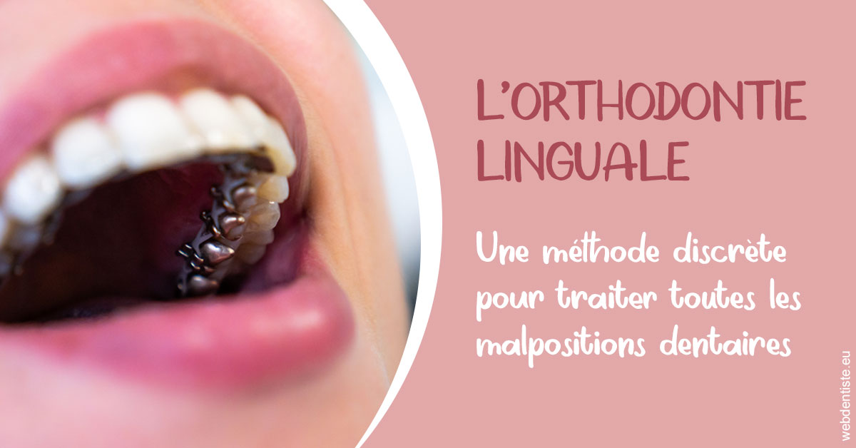 https://dr-abbou-michel.chirurgiens-dentistes.fr/L'orthodontie linguale 2