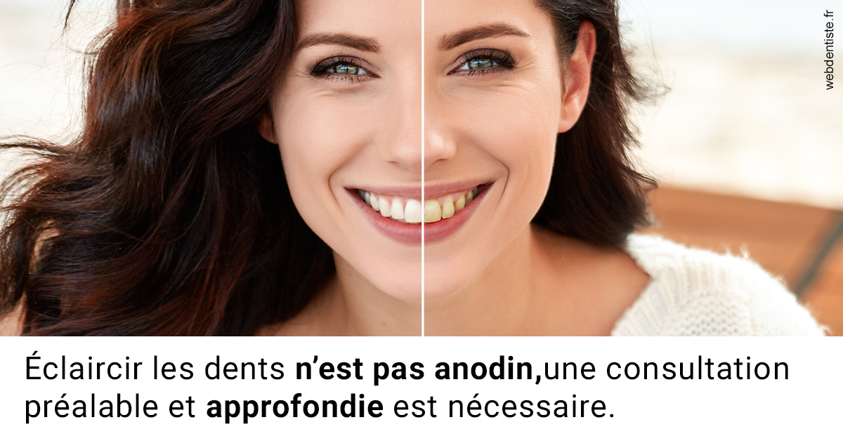 https://dr-abbou-michel.chirurgiens-dentistes.fr/Le blanchiment 2