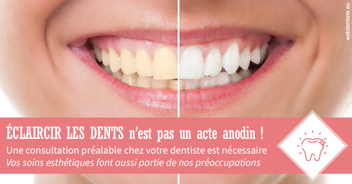 https://dr-abbou-michel.chirurgiens-dentistes.fr/Eclaircir les dents 1