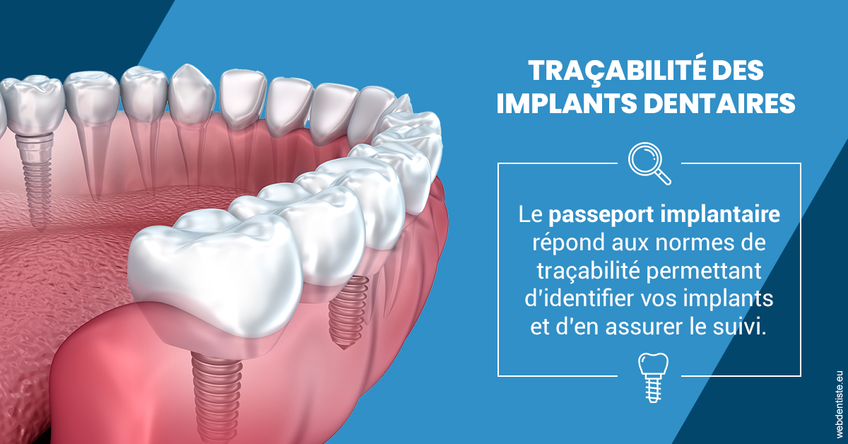 https://dr-abbou-michel.chirurgiens-dentistes.fr/T2 2023 - Traçabilité des implants 1
