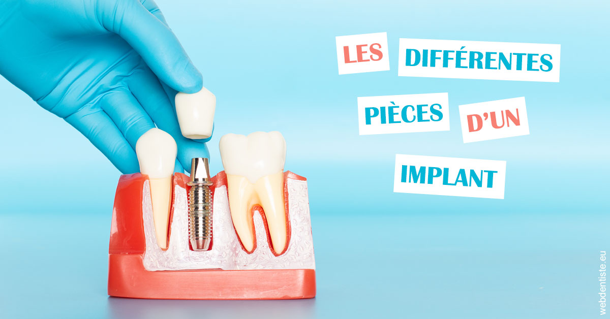 https://dr-abbou-michel.chirurgiens-dentistes.fr/Les différentes pièces d’un implant 2