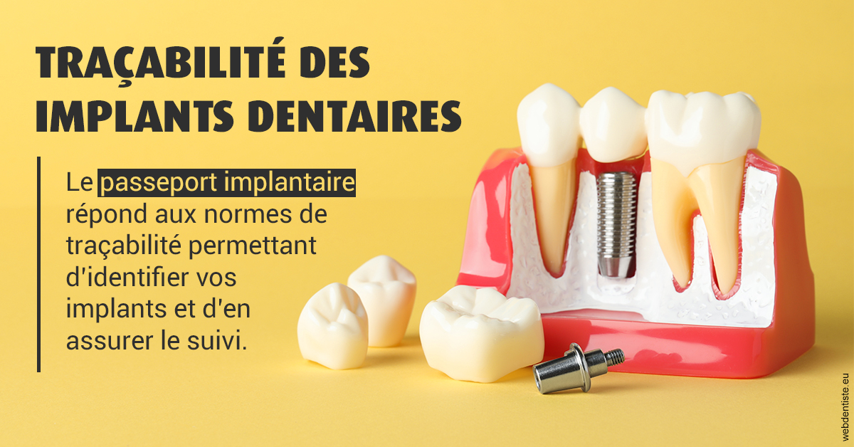 https://dr-abbou-michel.chirurgiens-dentistes.fr/T2 2023 - Traçabilité des implants 2