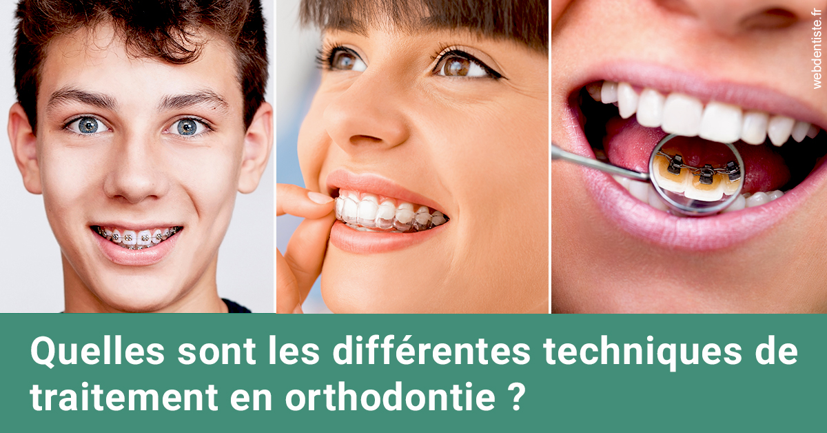 https://dr-abbou-michel.chirurgiens-dentistes.fr/Les différentes techniques de traitement 2