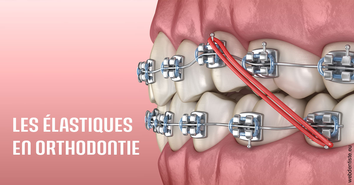 https://dr-abbou-michel.chirurgiens-dentistes.fr/Elastiques orthodontie 2