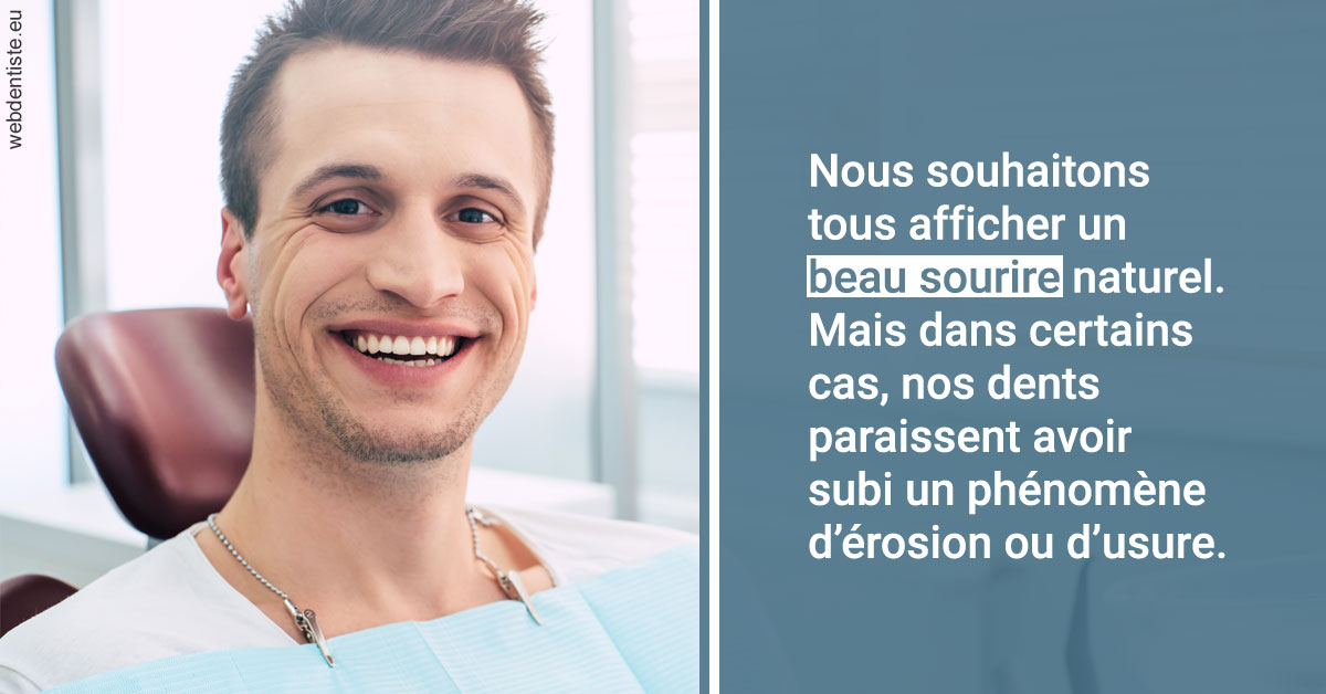 https://dr-abbou-michel.chirurgiens-dentistes.fr/Érosion et usure dentaire