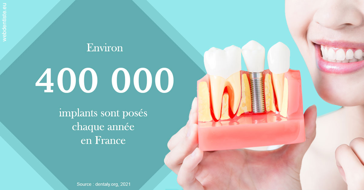 https://dr-abbou-michel.chirurgiens-dentistes.fr/Pose d'implants en France 2