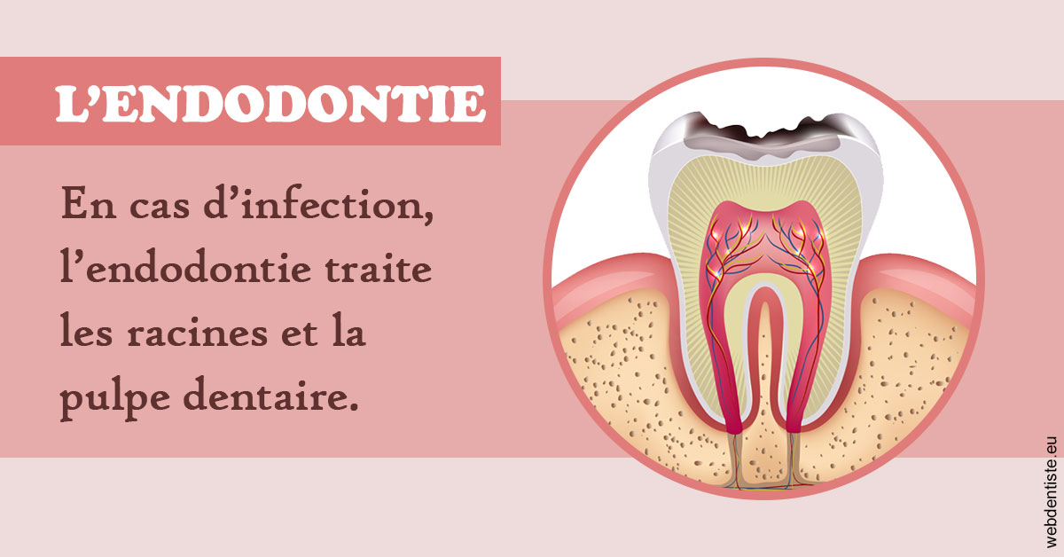 https://dr-abbou-michel.chirurgiens-dentistes.fr/L'endodontie 2