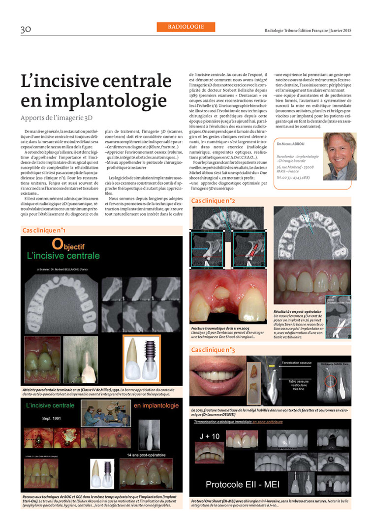 Dental Tribune Janvier 2015